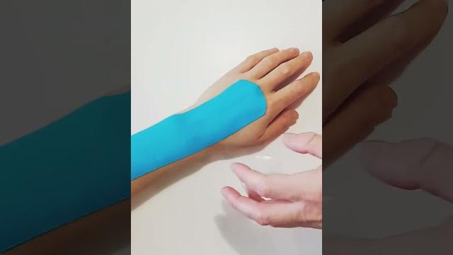 растяжение запястья | фиксируем кисть растяжение запястья | фиксируем кисть
