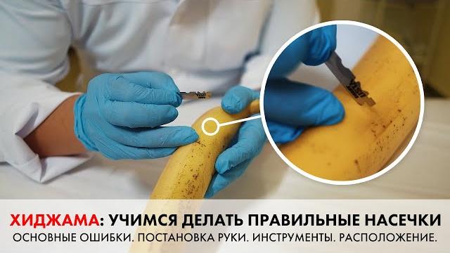 УРОК ПО ХИДЖАМЕ: НАСЕЧКИ. Оборудование, постановка руки, основные ошибки. Школа хиджамы Naza. УРОК ПО ХИДЖАМЕ: НАСЕЧКИ. Оборудование, постановка руки, основные ошибки. Школа хиджамы Naza.