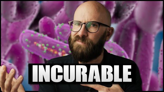 Marburg: The Completely Untreatable Virus Marburg: The Completely Untreatable Virus