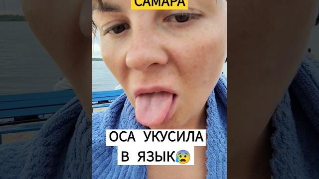 ОСА УКУСИЛА В ЯЗЫК ЕДЕМ ЧЕРЕЗ ВСЮ РОССИЮ НА МАШИНЕ#оса #укус #крымскиймост #путешествиенамашине ОСА УКУСИЛА В ЯЗЫК ЕДЕМ ЧЕРЕЗ ВСЮ РОССИЮ НА МАШИНЕ#оса #укус #крымскиймост #путешествиенамашине