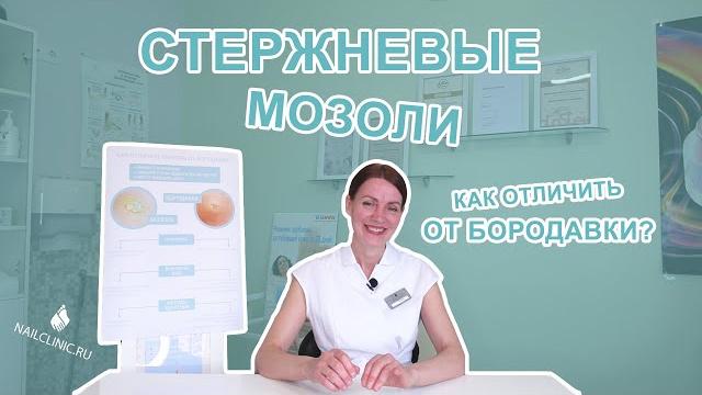 Стержневая мозоль. Удаление стержневой мозоли. Стержневая мозоль. Удаление стержневой мозоли.