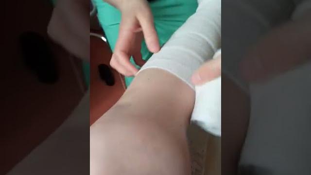 В ПАЛАТЕ || БИНТУЮТ НОГУ ПЕРЕД ОПЕРАЦИЕЙ || ЗАПОМНИТЕ МОЮ КОСТЬ: БОЛЬШЕ ВЫ ЕЕ НЕ УВИДИТЕ))) В ПАЛАТЕ || БИНТУЮТ НОГУ ПЕРЕД ОПЕРАЦИЕЙ || ЗАПОМНИТЕ МОЮ КОСТЬ: БОЛЬШЕ ВЫ ЕЕ НЕ УВИДИТЕ)))