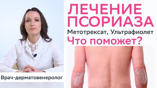 Лечение псориаза - метотрексат, кальципотриол, ультрафиолет, PUVA, грязевые ванны, солнечный загар Лечение псориаза - метотрексат, кальципотриол, ультрафиолет, PUVA, грязевые ванны, солнечный загар