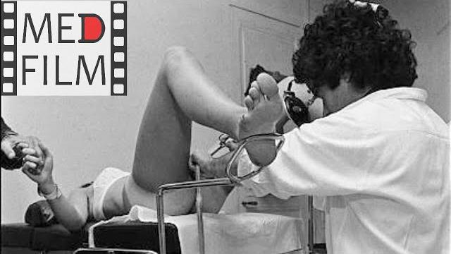 Аборт методом вакуум-экскохлеации © Abortion by vacuum excretion Аборт методом вакуум-экскохлеации © Abortion by vacuum excretion