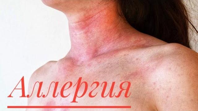 Аллергия. Дешевые лекарства от аллергии. Бюджетные аналоги дорогих лекарств от аллергии. Лоратадин. Аллергия. Дешевые лекарства от аллергии. Бюджетные аналоги дорогих лекарств от аллергии. Лоратадин.