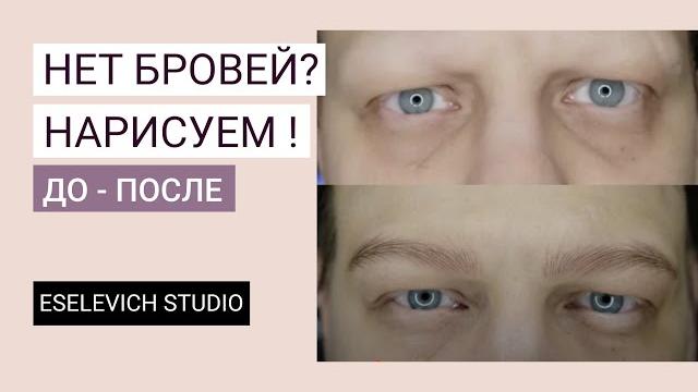 Татуаж бровей при алопеции у мужчин. Как сделать перманентный макияж мужчине? До и После! Татуаж бровей при алопеции у мужчин. Как сделать перманентный макияж мужчине? До и После!