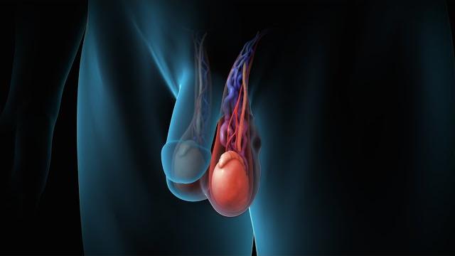Varicocele Repair Varicocele Repair