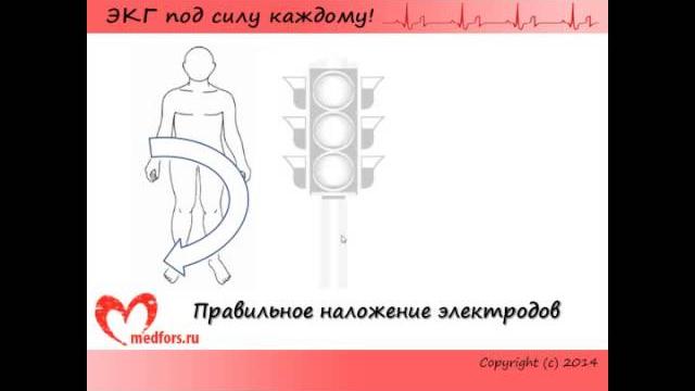 Урок 1. Видеокурс "ЭКГ под силу каждому". Урок 1. Видеокурс "ЭКГ под силу каждому".