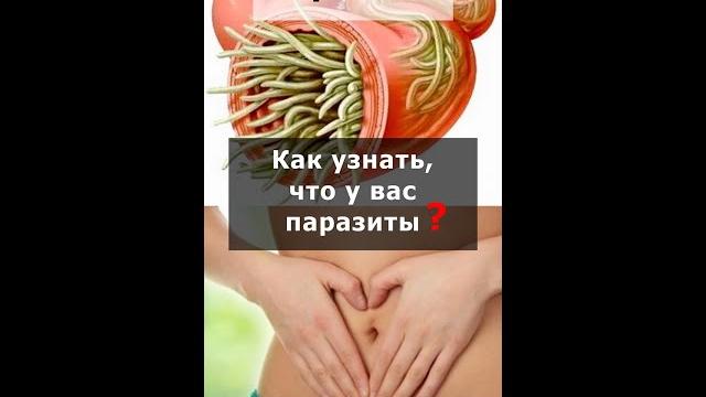 7 признаков ПАРАЗИТОВ. Как узнать, что у вас глисты в организме – симптомы заражения гельминтами 7 признаков ПАРАЗИТОВ. Как узнать, что у вас глисты в организме – симптомы заражения гельминтами