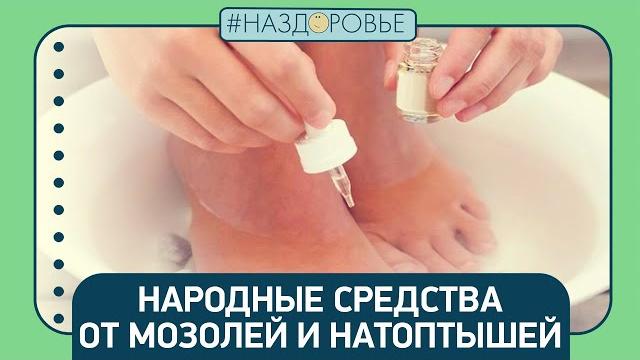 #НАЗДОРОВЬЕ: народные средства от мозолей #НАЗДОРОВЬЕ: народные средства от мозолей