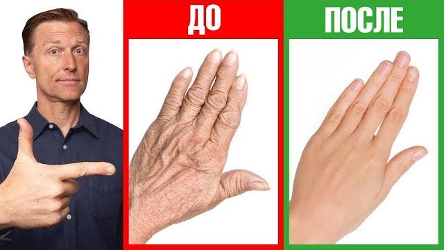 Сухость кожи рук и трещины на руках? Лучшее домашнее средство Сухость кожи рук и трещины на руках? Лучшее домашнее средство