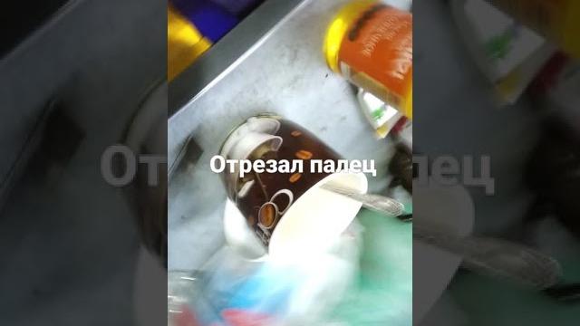 канцелярским ножом отрезал палец канцелярским ножом отрезал палец