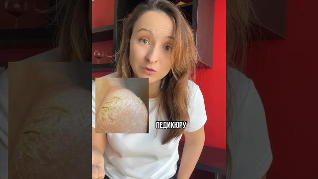 Почему трескаются пятки? Почему трескаются пятки?
