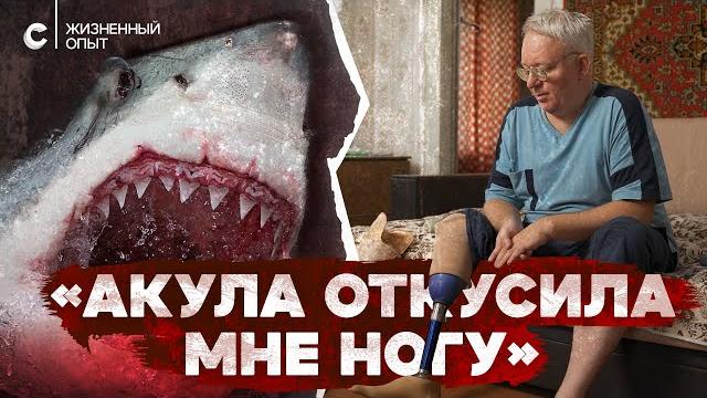 «Вместо ноги только кость торчит». Пережил нападение акулы «Вместо ноги только кость торчит». Пережил нападение акулы