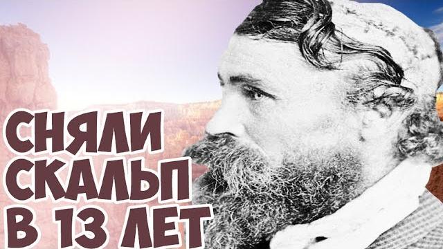 ОН СМОГ ВЫЖИТЬ ПОСЛЕ СКАЛЬПИРОВАНИЯ! ОН СМОГ ВЫЖИТЬ ПОСЛЕ СКАЛЬПИРОВАНИЯ!