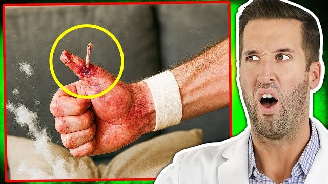 ER Doctor REACTS to DUMBEST Injuries on the Internet ER Doctor REACTS to DUMBEST Injuries on the Internet