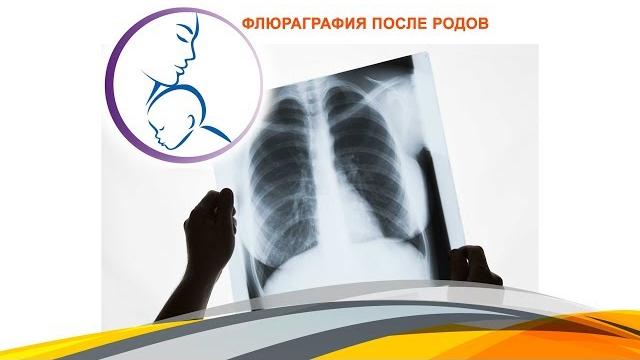 Флюраграфия после родов История рассказанная в нашем эфире накануне получила неожиданное продолжени Флюраграфия после родов История рассказанная в нашем эфире накануне получила неожиданное продолжени