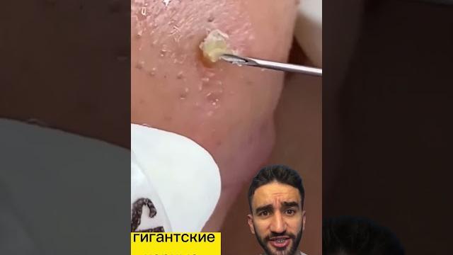 это что гигантские черные точки? это что гигантские черные точки?