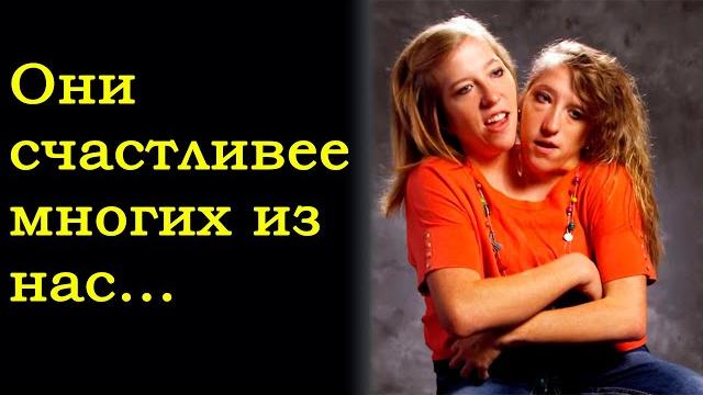 Сиамские близнецы Эбигейл и Бриттани Хенсел Сиамские близнецы Эбигейл и Бриттани Хенсел