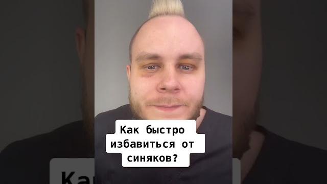 Как быстро избавиться от синяков. Как быстро избавиться от синяков.