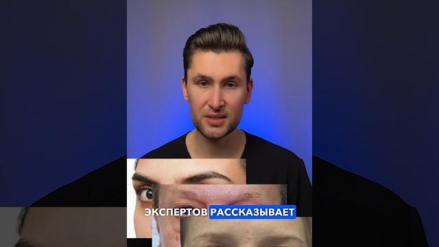 Почему появляются мешки под глазами? Почему появляются мешки под глазами?