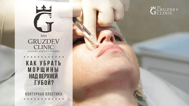 Как убрать морщины над верхней губой? Как убрать морщины над верхней губой?