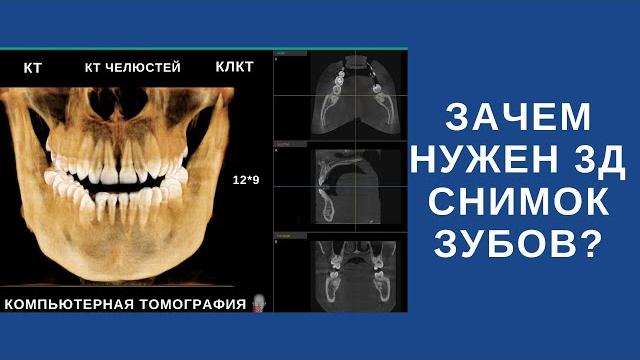Что такое 3д снимок зубов и зачем он нужен? Что такое 3д снимок зубов и зачем он нужен?