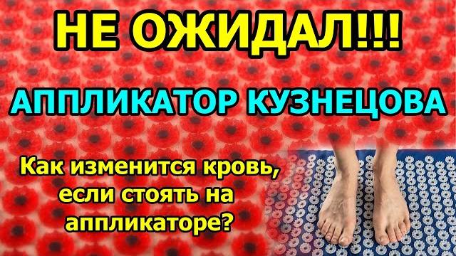 Кровь после аппликатора Кузнецова. Не ожидал Кровь после аппликатора Кузнецова. Не ожидал
