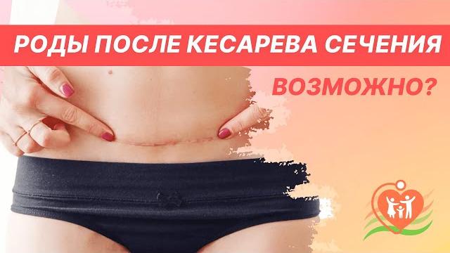 Естественные роды после кесарева сечения. Рубец на матке - возможны ли роды после кесарева? Естественные роды после кесарева сечения. Рубец на матке - возможны ли роды после кесарева?