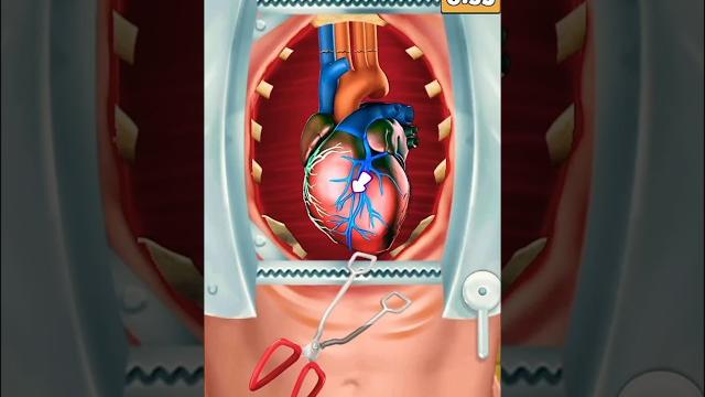 How Heart Transplant Is Done? How Heart Transplant Is Done?