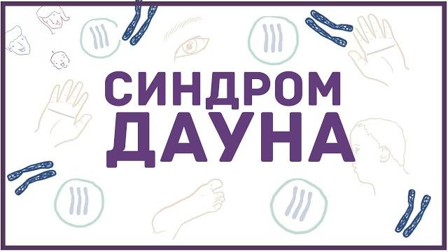 Синдром Дауна - причины, симптомы, диагностика - кратко Синдром Дауна - причины, симптомы, диагностика - кратко