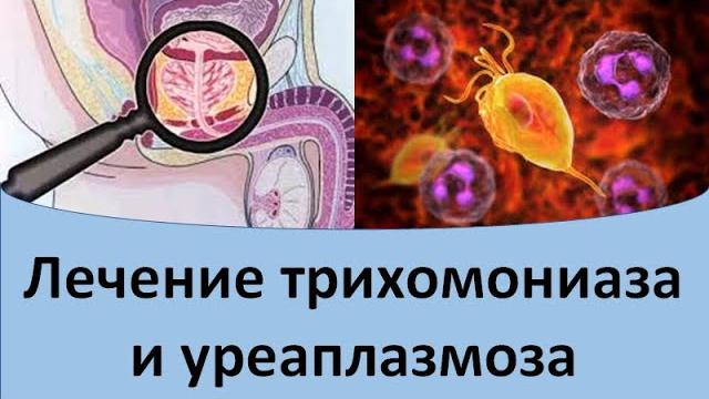 Лечение трихомониаза и уреаплазмоза Лечение трихомониаза и уреаплазмоза