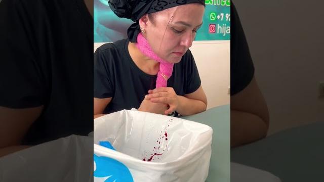 Hijama.pro__ кровопускания с лба +7-925-571-07-77 Hijama.pro__ кровопускания с лба +7-925-571-07-77