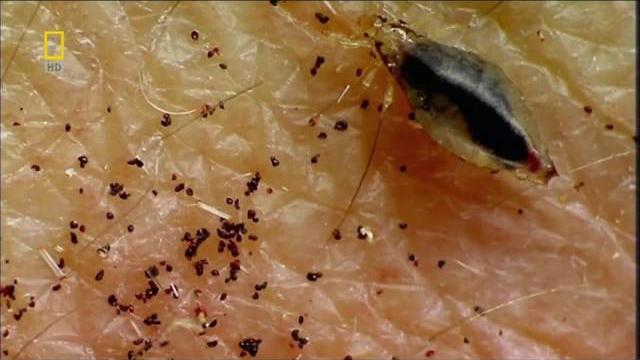 Нательная вошь (Pediculus corporis) под микроскопом Нательная вошь (Pediculus corporis) под микроскопом