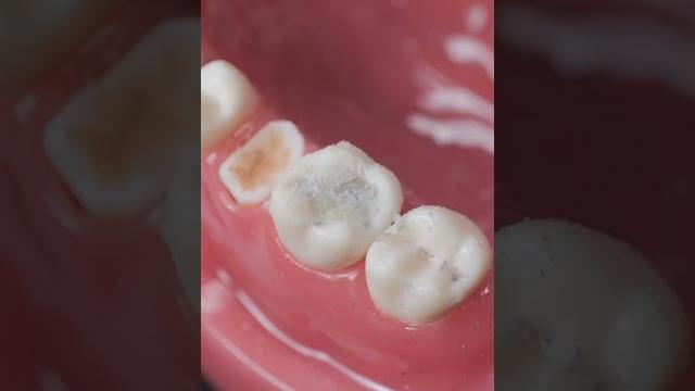 You Won’t Believe How Easy It Is to Fix Your Teeth! But Why Is It Always So Expensive? You Won’t Believe How Easy It Is to Fix Your Teeth! But Why Is It Always So Expensive?