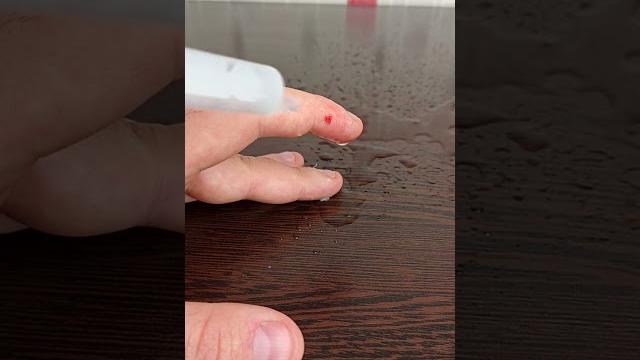Как избавиться от укуса хомяка. Последствия укуса Как избавиться от укуса хомяка. Последствия укуса