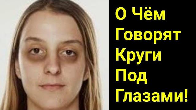 Тёмные Круги Под Глазами | Доктор Вивек Тёмные Круги Под Глазами | Доктор Вивек