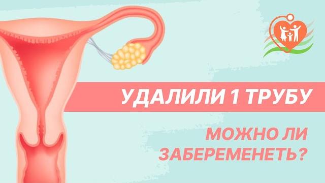 Удалили 1 трубу - можно ли забеременеть? Удалили 1 трубу - можно ли забеременеть?