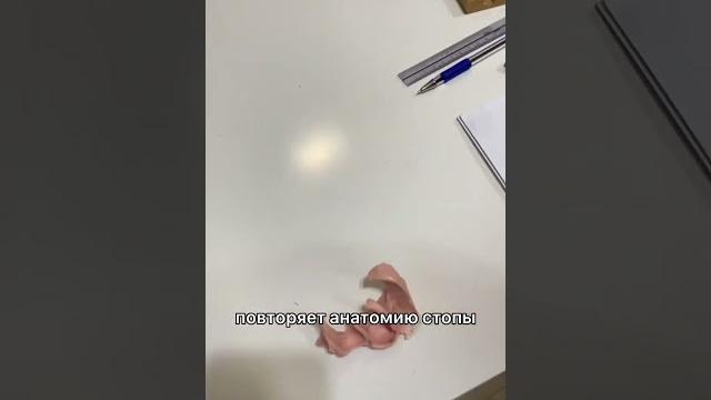 Когда мозоли на пальцах стопы #shorts #мозоль #ортопед Когда мозоли на пальцах стопы #shorts #мозоль #ортопед