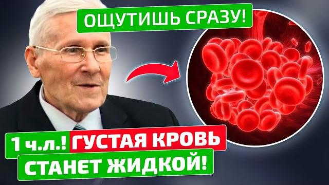Болотов: Разжижать кровь просто, даже без аспирина! Болотов: Разжижать кровь просто, даже без аспирина!