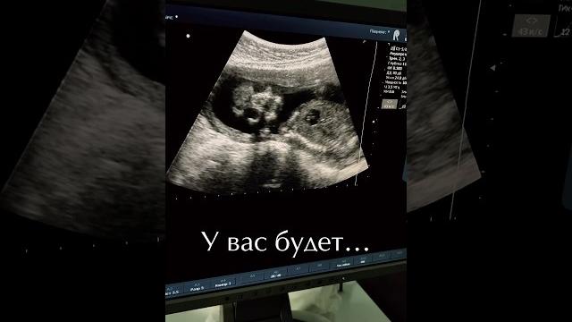 Неожиданно #беременность #юмор #дети #материнство #baby #прикол #роды #cute #babygirl #тренды #ma Неожиданно #беременность #юмор #дети #материнство #baby #прикол #роды #cute #babygirl #тренды #ma