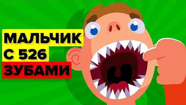 Мальчик-акула с 526 зубами (реальная история) Мальчик-акула с 526 зубами (реальная история)