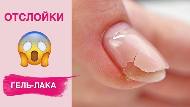 Причины отслойки гель-лака | Секреты носки маникюра Причины отслойки гель-лака | Секреты носки маникюра