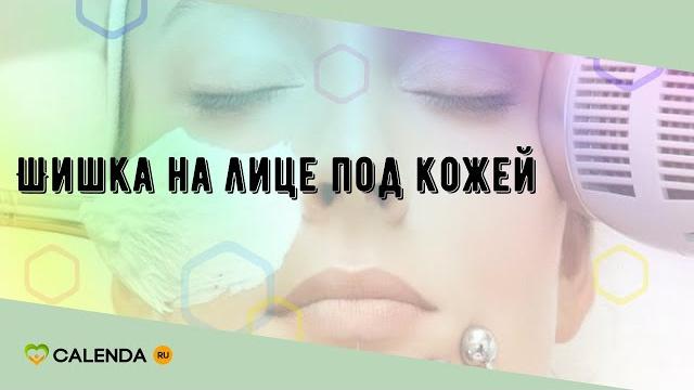 Шишка на лице под кожей Шишка на лице под кожей