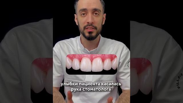 Как выглядят классные виниры Как выглядят классные виниры