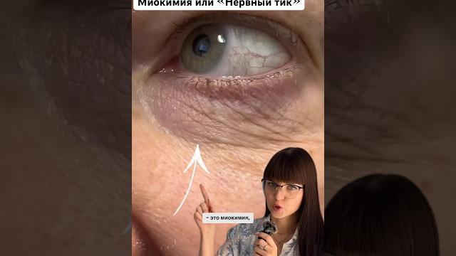 ДЕРГАЕТСЯ ГЛАЗ ДЕРГАЕТСЯ ГЛАЗ
