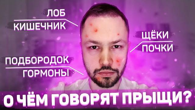 Карта прыщей. Что означает расположение прыщей на лице? Карта прыщей. Что означает расположение прыщей на лице?