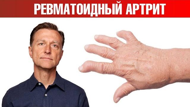 13 натуральных средств от ревматоидного артрита 13 натуральных средств от ревматоидного артрита
