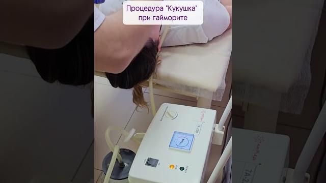 «Кукушка» при гайморите «Кукушка» при гайморите