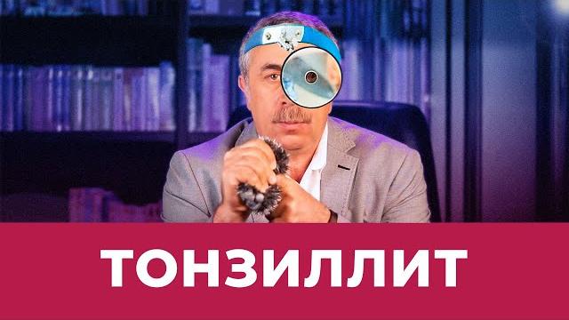 Хронический тонзиллит Хронический тонзиллит